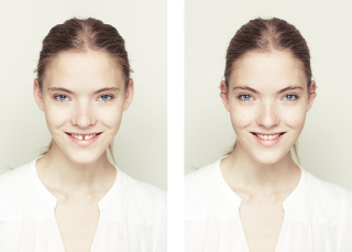 Illustration for article titled Is a perfectly symmetrical face actually the most beautiful?
